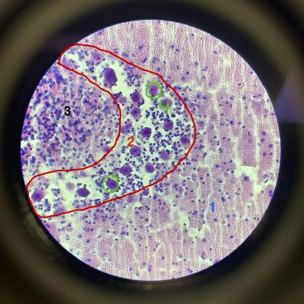 Cerebelo 40x (1)