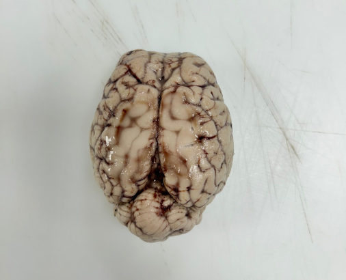 CerebroInfoA