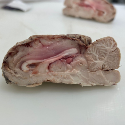 CerebroInfoC