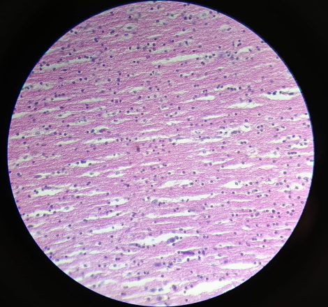 G3_CEREBRO_HEMATOXILINA Y EOSINA DE MAYER_ 40x