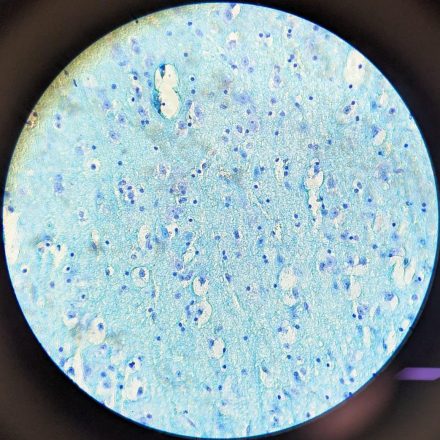 G3_CEREBRO_LUXOL FAST BLUE_40X