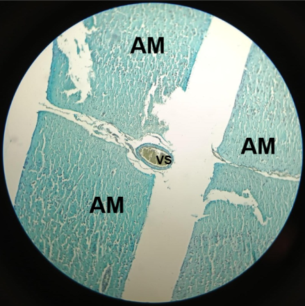 G3_Cerebro_AzulAlcian_10X_Señal2