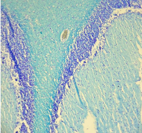 G4_Luxol Fast Blue_Cerebelo_20x-02