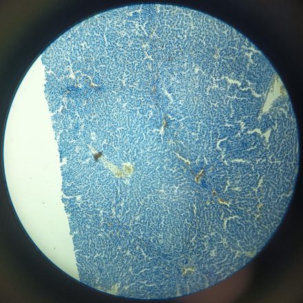 G5_HÍGADO_AZUL DE TOLUIDINA_10X