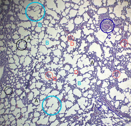 Grupo4_10X_HE_PulmónSeñalado